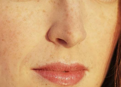 珠海去眉間紋手術(shù)醫(yī)生