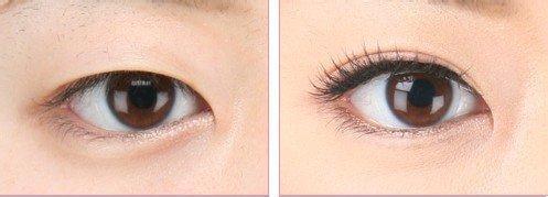 【精選】信陽整形醫(yī)院匯總單超熱門排行榜更新中！輕松掌握易韓、東方藝口碑（技術(shù)）的獨門秘籍