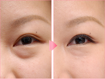 上海整形醫(yī)院最佳選擇！潔銘、伊萊美、時光、藝星等實(shí)力醫(yī)院推薦！