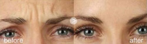 北京手指整形手術醫(yī)院推薦：頂尖機構全覆蓋，你的理想之選