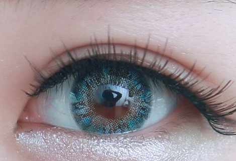 周口激光祛疤凹陷疤痕醫(yī)生