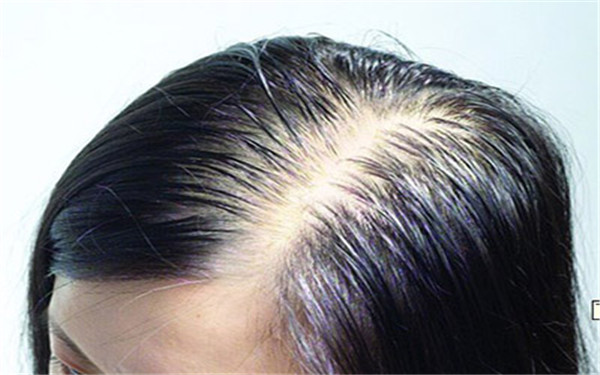 蘭州頂級(jí)整形專家推薦：激光祛斑三甲醫(yī)院排行榜！專業(yè)機(jī)構(gòu)值得信賴！