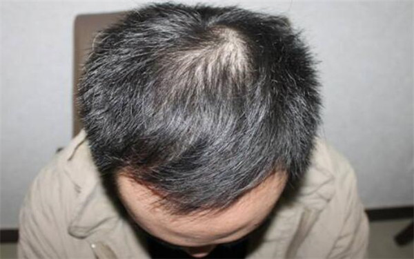 南昌三甲醫(yī)院全面盤點(diǎn)：專業(yè)美容整形醫(yī)院推薦，趕緊了解一下！