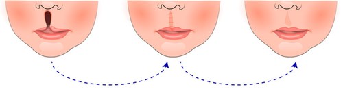 北京種植牙專家團隊超卓，醫(yī)院名列前茅！