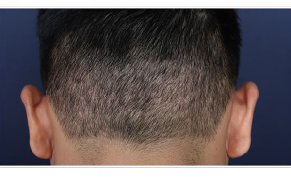 北京整形醫(yī)院排行榜出爐！磨骨整形權(quán)威推薦TOP10，包括【八大處】以外還有其他九家推薦！