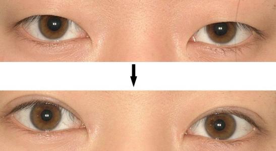 廈門哪家三甲整形醫(yī)院口碑最好？大揭秘，公立還是私立更值得信賴！