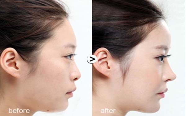 北京眼袋手術醫(yī)院匯總：前五強推薦，不容錯過！