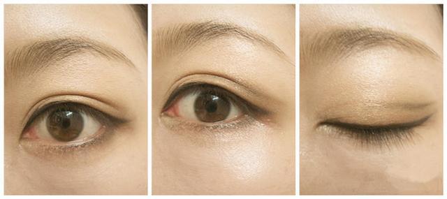 北京治療眼袋效果最好的公立醫(yī)院排行榜發(fā)布！頂級醫(yī)療機構全在列