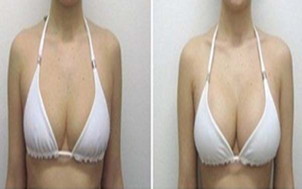 西安電波拉皮去蝴蝶斑醫(yī)生