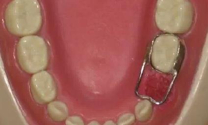 保定整形醫(yī)院雙眼皮割刀痕排行榜揭曉！丨華美、藍山哪家更受保定人喜愛？