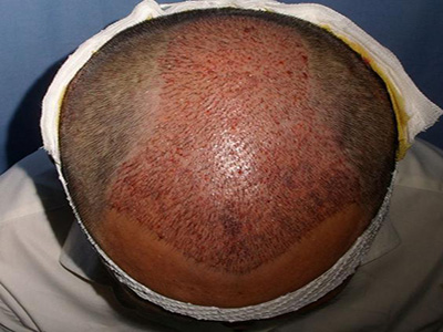 南京優(yōu)秀的合法醫(yī)學(xué)美容醫(yī)院推薦！當(dāng)?shù)貦?quán)威整形機(jī)構(gòu)品質(zhì)保障~