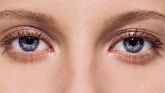 ?？陧n式小切口重瞼醫(yī)生