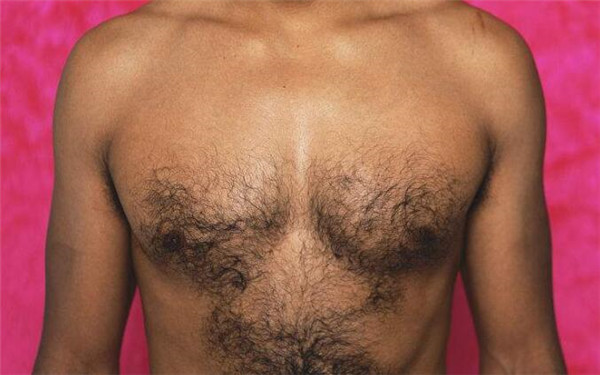 北京哪家醫(yī)院祛斑效果最好？匯總5家頂級醫(yī)院供參考！附最新價目表揭曉！