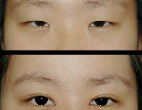 頭五！眼霞醫(yī)美奪魁，藍(lán)溪和悅色重要三強(qiáng)，輿論瘋傳！