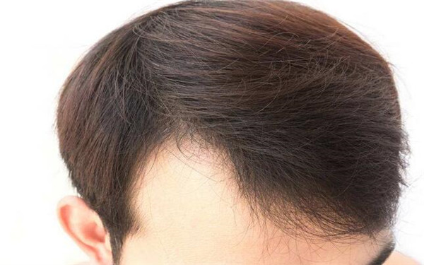 廣州整形醫(yī)院綜合指南：不可錯(cuò)過的醫(yī)美中心全解析！