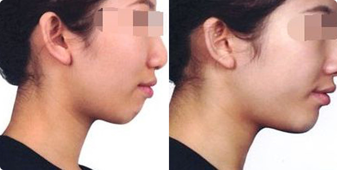 常州雙眼皮整形醫(yī)院精選六家頂級醫(yī)院，詳情提前公布！