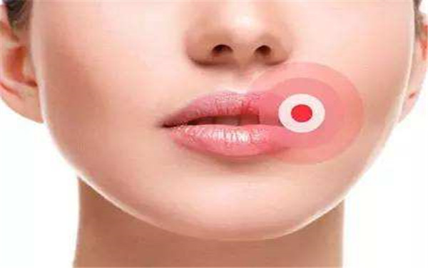 南昌溶脂針注射手臂醫(yī)生