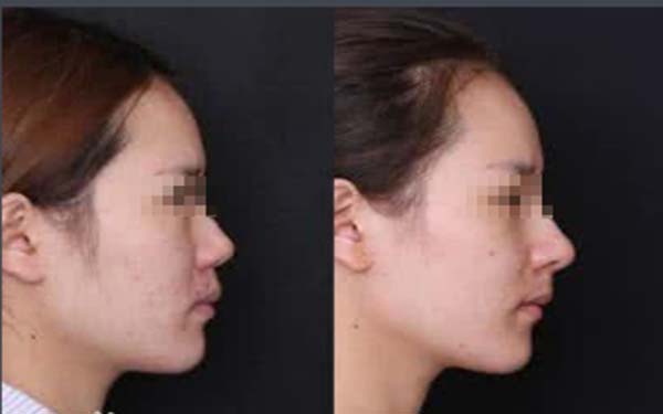 天津美容科醫(yī)院匯總前五，公立機(jī)構(gòu)解決方案公開！