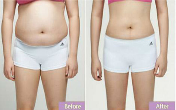 常德眼袋手術(shù)推薦排名TOP10！公私醫(yī)院詳細(xì)對(duì)比，看看你選對(duì)了沒(méi)有