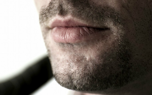 嘉興祛斑醫(yī)院推薦排行榜，藝星醫(yī)療和曙光皮膚?？颇募腋孔V？