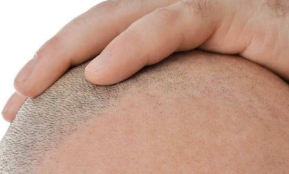 常州最好的激光祛斑醫(yī)院推薦：這些醫(yī)療機(jī)構(gòu)專業(yè)有力，效果明顯！快來(lái)看看！