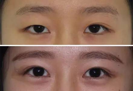 寧波瘦背整形醫(yī)院排行榜【3家】