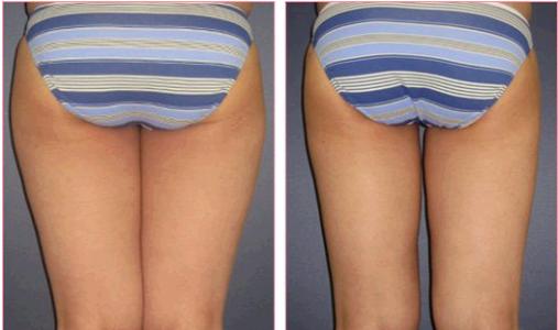 天津治療疤痕疙瘩醫(yī)院排行榜：文怡、坤如瑪麗引人矚目！