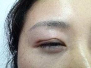 廣州隆鼻手術(shù)：挑選最好的醫(yī)生，口碑盤點(diǎn)！是否有你最滿意的專家？