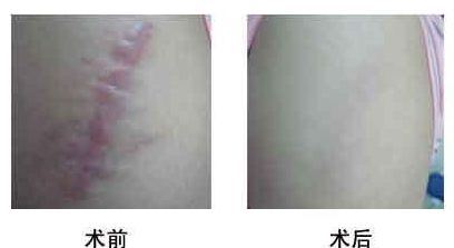 衡陽(yáng)面部削骨醫(yī)生