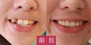 哪家醫(yī)院適合進行磨骨手術(shù)？江城和美立方廣受網(wǎng)友推崇！