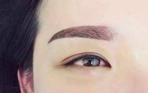 包頭光子美容淡化斑醫(yī)生