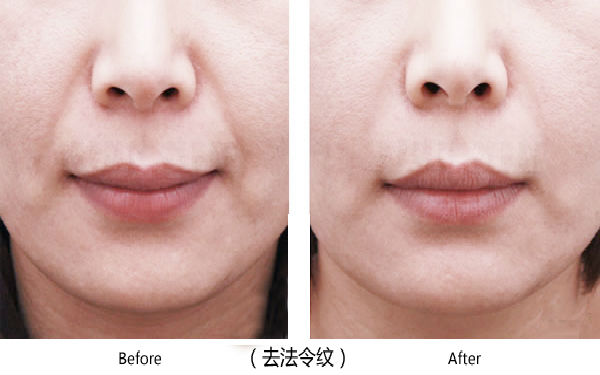 廣東五家頂級(jí)醫(yī)院震撼推出胎記治療榜單，治愈百姓容顏障礙！