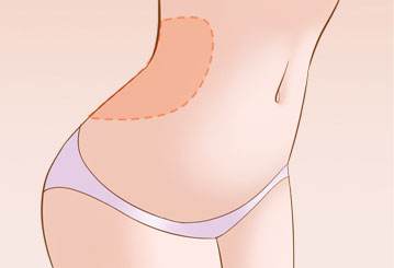 呼市哪家醫(yī)院最受歡迎？雙眼皮效果超過80%的用戶推薦！