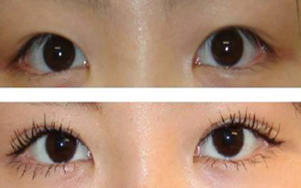 廣東疤痕修復專科醫(yī)院榜單：8家被推薦的醫(yī)院表現出色