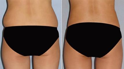 成都最受好評的整形醫(yī)院匯總，專業(yè)拉皮手術效果一流