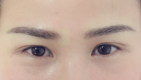 揭秘玉溪整形醫(yī)院匯總：華藝、吳氏嘉美等排行前六，此刻揭開！