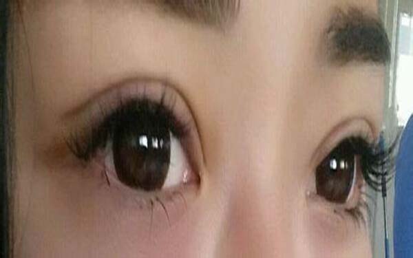 張家口市隆胸整形醫(yī)院排行榜：性價(jià)比之選一定適合你