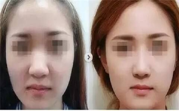 杭州最受歡迎的整形醫(yī)院推薦！匯總市場口碑最好的八家醫(yī)美機(jī)構(gòu)，綜合評價超乎想象，專業(yè)水平極高！