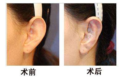 杭州首家頂級玻尿酸修復(fù)醫(yī)院：珠兒美容醫(yī)院實力獲得廣泛認可