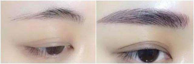 技巧傳授：西安玻尿酸醫(yī)院攻略，經驗豐富專家詮釋