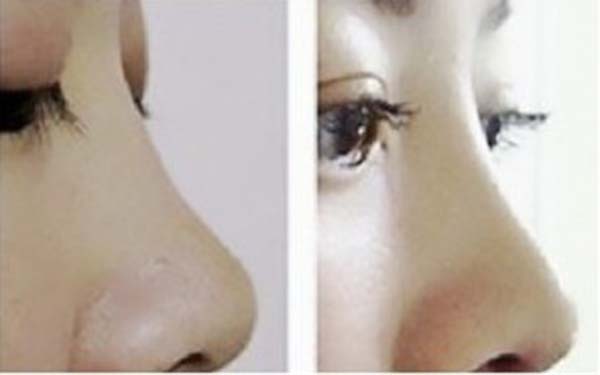 揭秘深圳三家知名整容機(jī)構(gòu)，助你尋找信賴(lài)的美容醫(yī)院