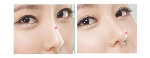 揭秘西安豐胸三甲醫(yī)院專家評選！西京、唐都脫穎而出，實(shí)力堪比五強(qiáng)！