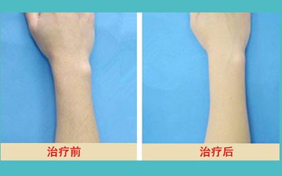 最新發(fā)布！匯總?cè)箩t(yī)院名單，解決牙齒問題待了整整一年