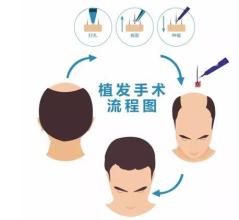 昆明哪家隆鼻醫(yī)院比較靠譜？【10所信譽(yù)極高的醫(yī)療機(jī)構(gòu)】