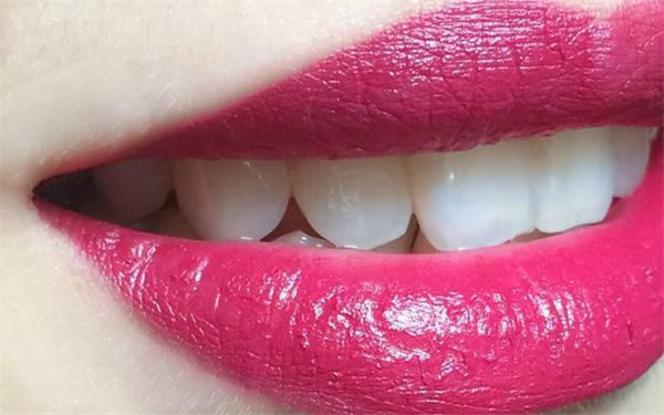 江門眼角整形醫(yī)生