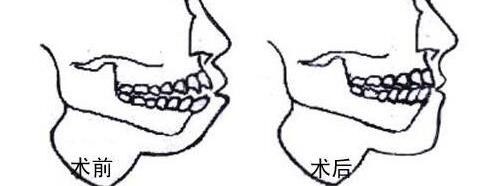 提供重慶哪家私立醫(yī)院割雙眼皮好？前五推薦_軍美領(lǐng)先，再揭秘