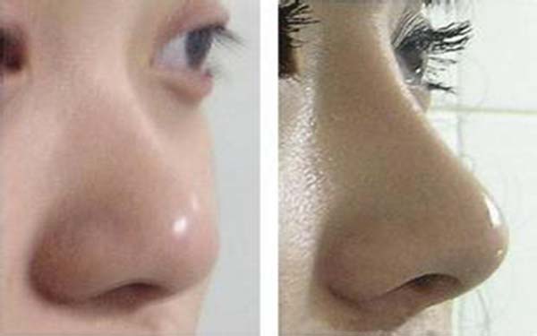 杭州口碑最佳的整形醫(yī)院盤點！匯總七家頂級醫(yī)療機(jī)構(gòu)，專注為您帶來品質(zhì)醫(yī)美服務(wù)