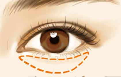 懷化哪家醫(yī)院做臉部脂肪填充效果好？2023年價(jià)目表全知道，去評(píng)價(jià)最好的六家吧！