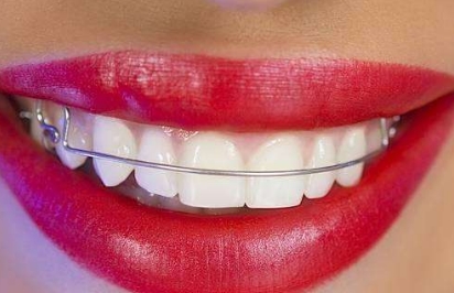 杭州頂級(jí)乳房整形機(jī)構(gòu)排名榜單 TOP5，藝星、靜港等網(wǎng)紅實(shí)力不容小覷！