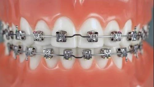 昆明頂級(jí)牙科醫(yī)院排行榜出爐！整牙專家力壓群雄，技術(shù)高超